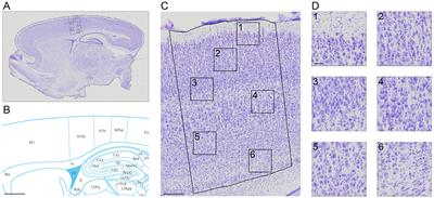 Cell density quantification of high resolution Nissl images of the juvenile rat brain